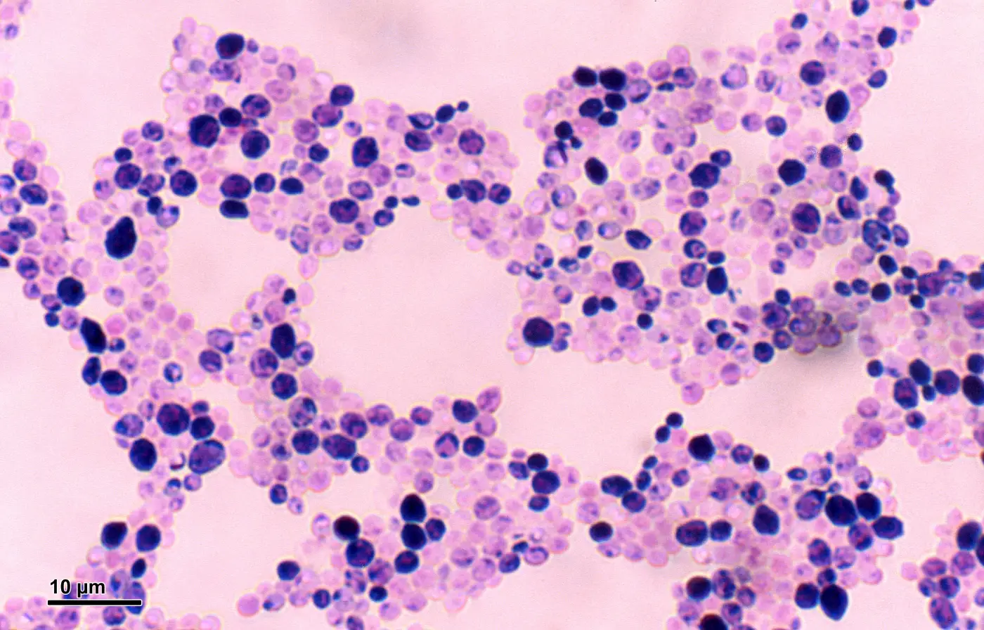 Candida albicans observada ao microscópio